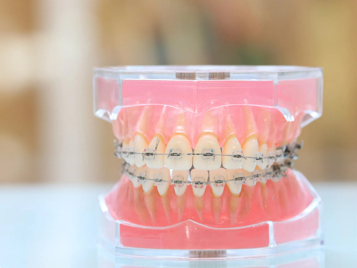 3D クリスタル　歯 矯正歯科 - 名古屋でインプラント治療なら、クリスタル歯科｜歯科恐怖